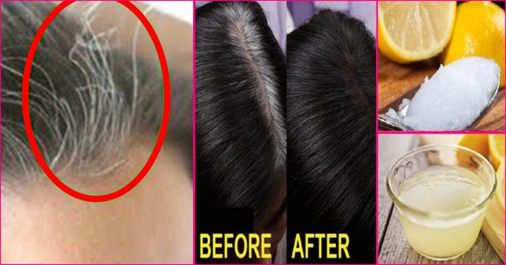 White Hair