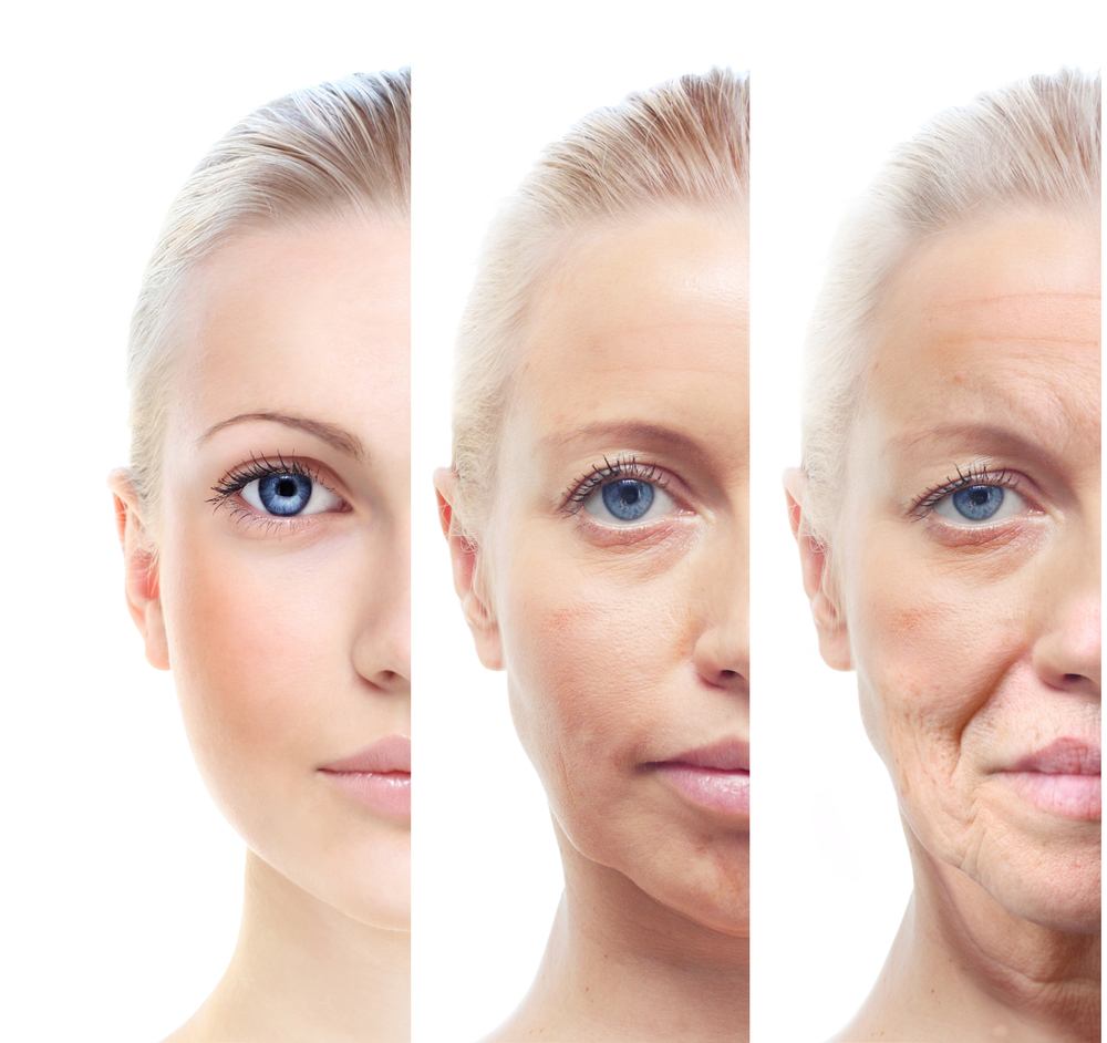 Facelift Surgery