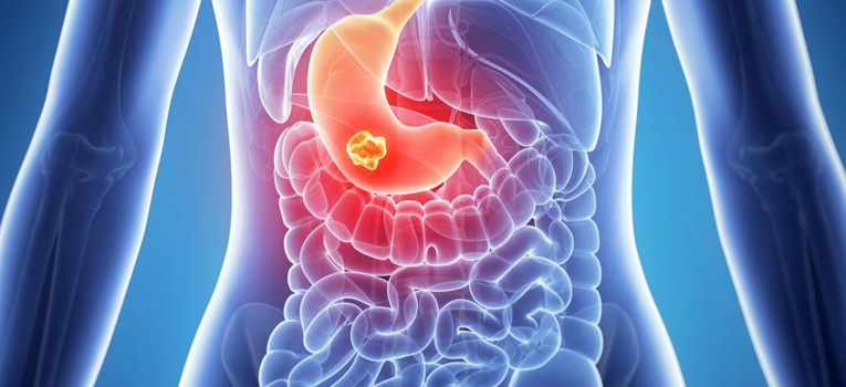 Stomach Protection